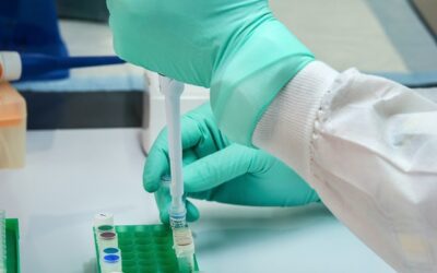 Identifican la secuencia de ADN que causa los casos más severos de lupus