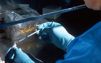 Cada vez más los hombres se someten a tratamientos de bótox